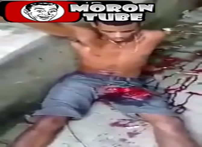 Video: A Brazilian thug who was shot in the wrong spot loses his genitalia